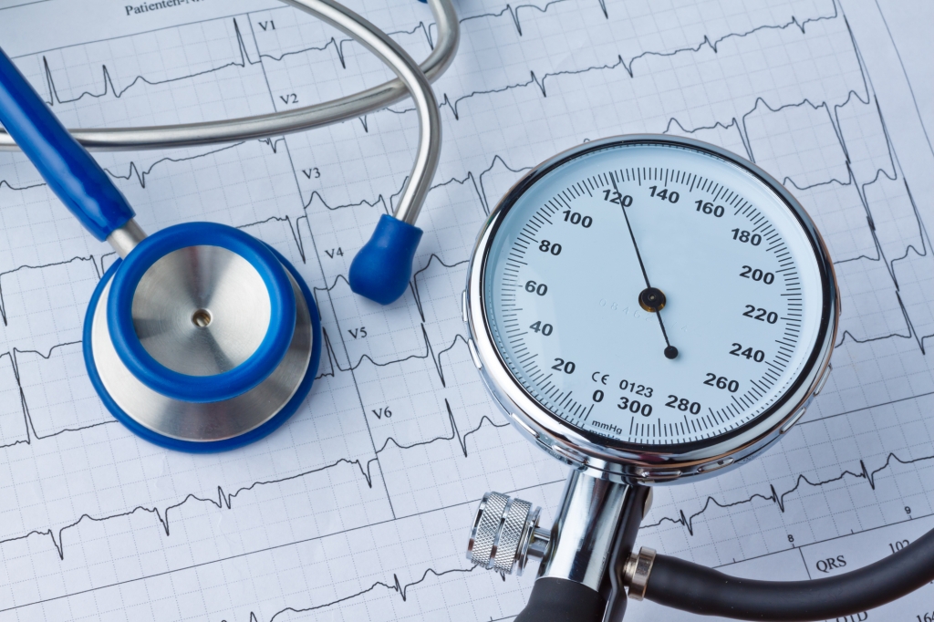 Dijagnostika – Kako interpretirati nalaz kontinuiranog mjerenja arterijskog tlaka?